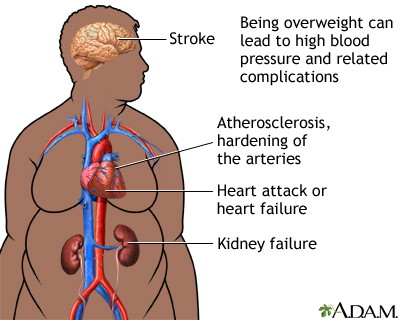 Extreme weight loss washington dc image 10